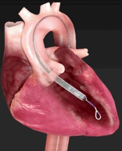 A close-up of a heart

Description automatically generated