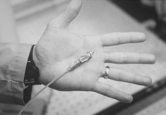 A hand with a needle on it

Description automatically generated