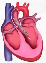 A close-up of a heart

Description automatically generated