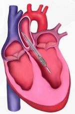 A close-up of a heart

Description automatically generated