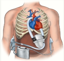 A human body with heart and lungs

AI-generated content may be incorrect.