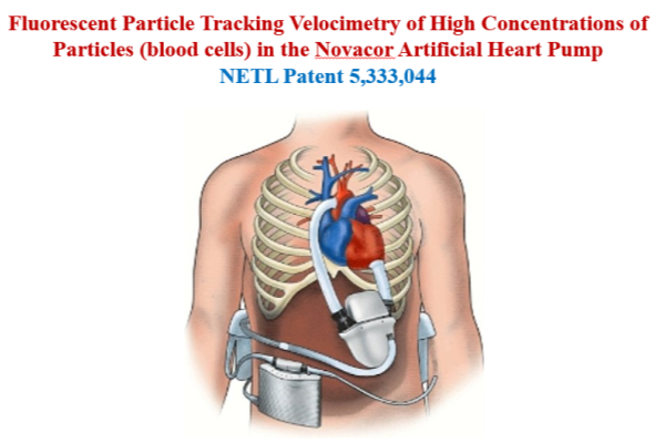 A human body with a heart and lungs

Description automatically generated