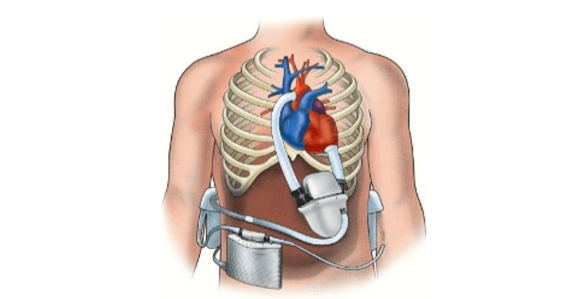A human body with a heart and lungs

Description automatically generated