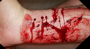 A bloody arm with blood on it

AI-generated content may be incorrect.