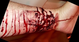 A bloody arm with a white background

AI-generated content may be incorrect.